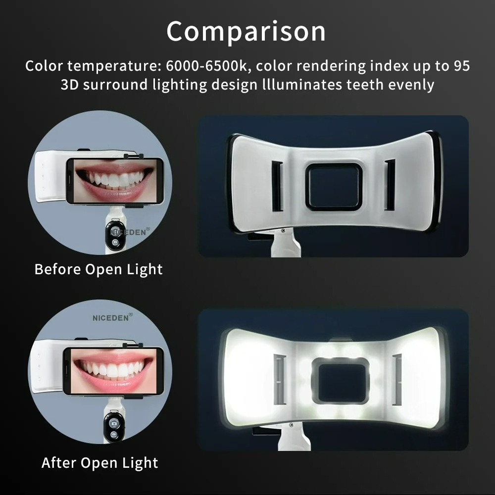 Dental Photography Light Phone - Phone Accessories For Photography review and price