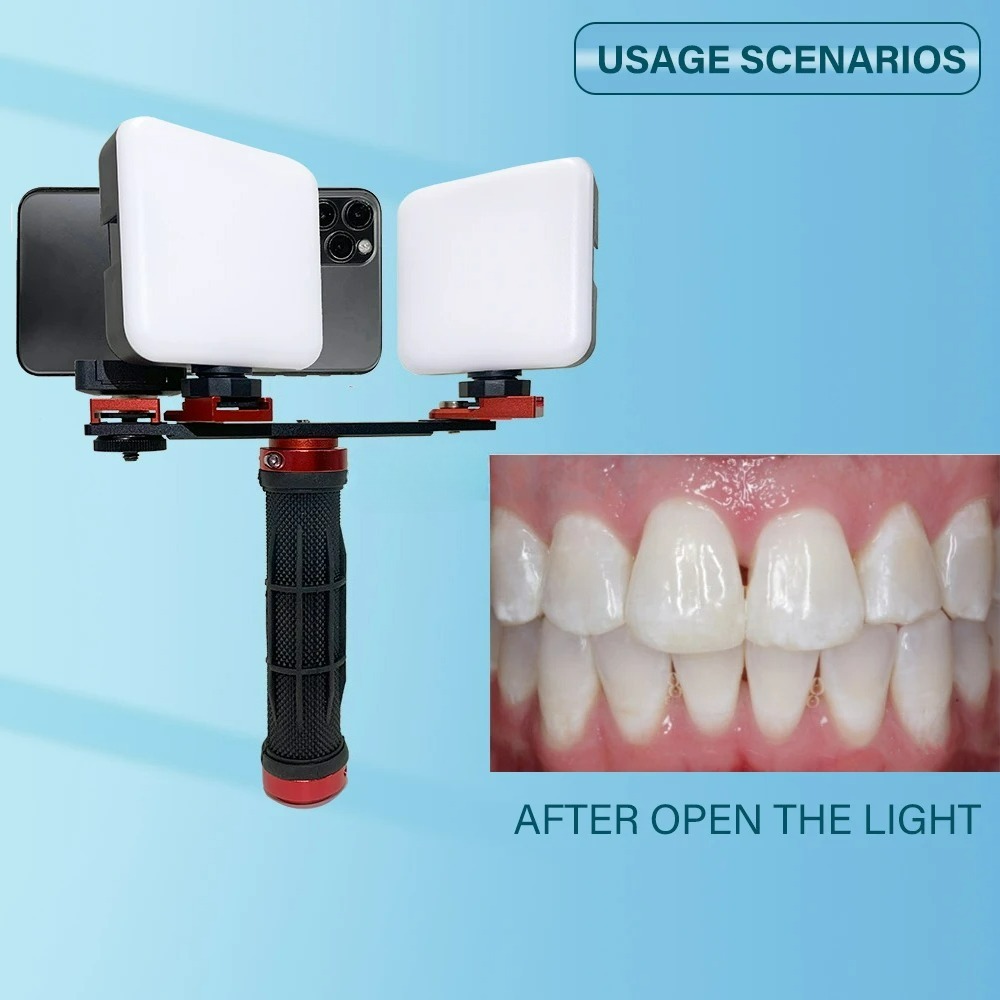 Dental Photography Light Phone - Phone Accessories For Photography review and price