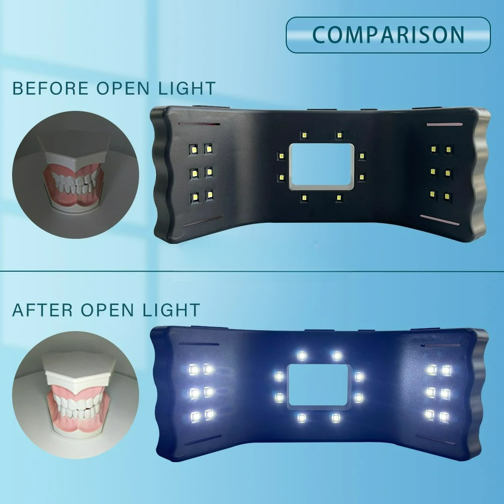 Dental Photography Light Phone - Phone Accessories For Photography review and price